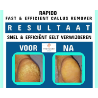 PodoCura Rapido Eeltweker 1 L – professionele softener